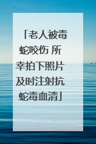 老人被毒蛇咬伤 所幸拍下照片及时注射抗蛇毒血清
